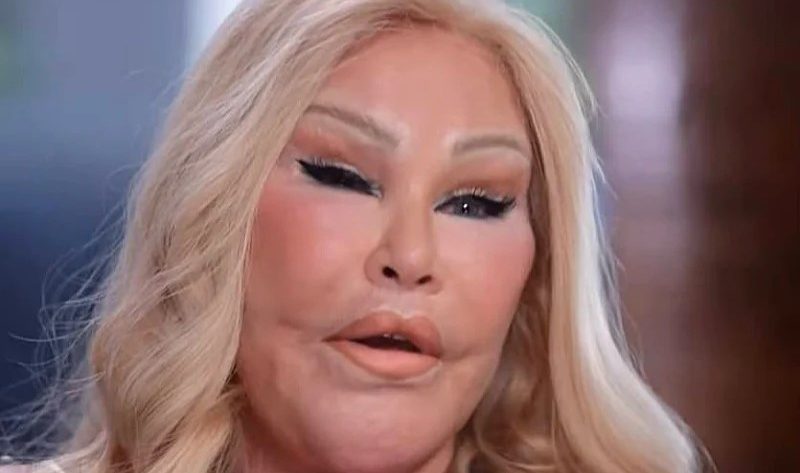 Jocelyn Wildenstein – metryka [wiek, wzrost, mąż i dzieci, pochodzenie, rodzina, życiorys]